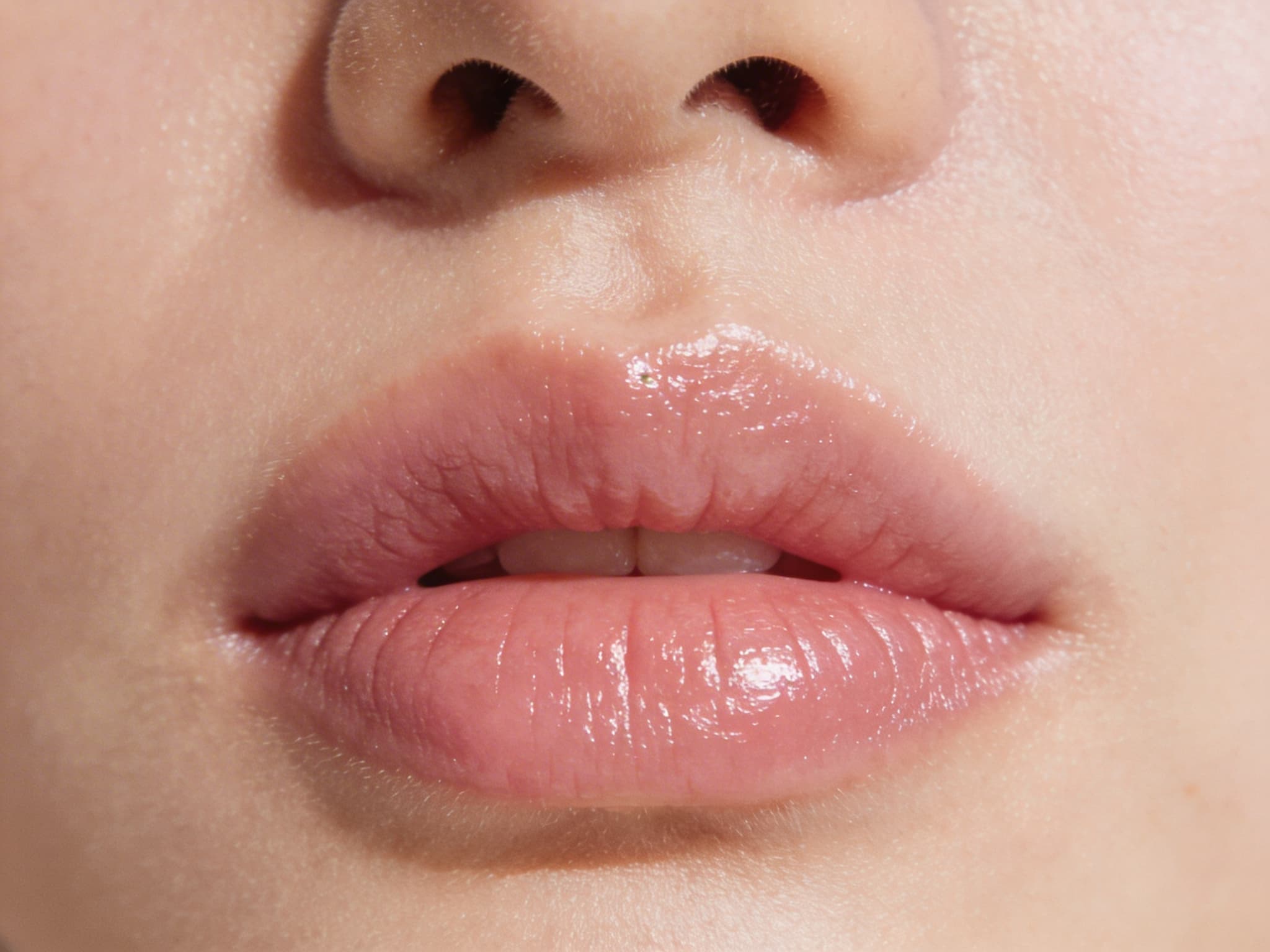 Lèvres naturelles : la tendance des augmentations subtiles en 2026 - Traitements du Visage