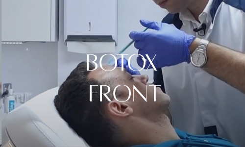 Injection de botox sur le front d'un patient réalisée par un professionnel en médecine esthétique.