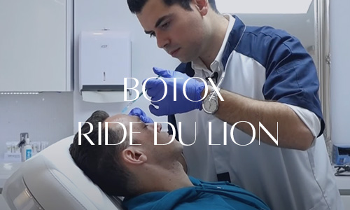 Injection de botox pour traiter la ride du lion d'un patient par un spécialiste en médecine esthétique.