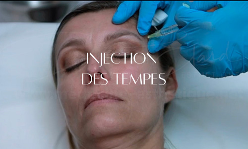 Injection d'acide hyaluronique dans les tempes pour combler les creux et harmoniser le contour du visage.