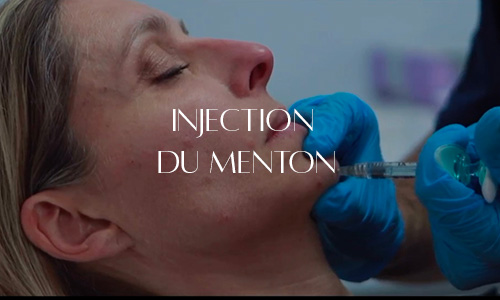 Injection d'acide hyaluronique dans le menton pour améliorer la projection et l'harmonie du bas du visage.