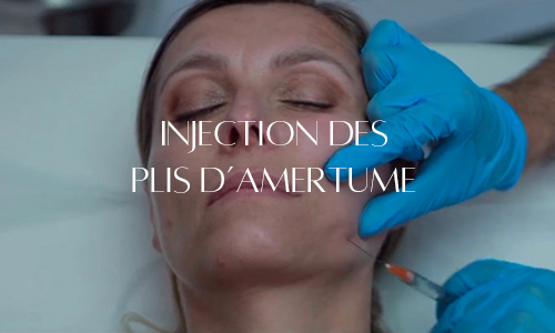 Injection d'acide hyaluronique pour corriger les plis d'amertume, visant à restaurer l'harmonie et la douceur du visage.