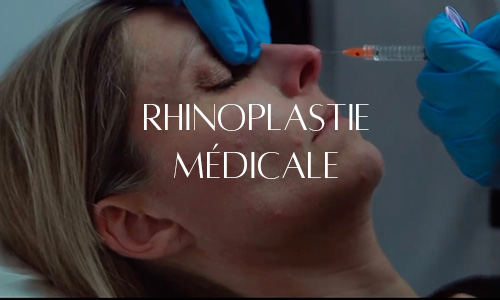 Injection dans le nez dans le cadre d'une rhinoplastie médicale, réalisée par un professionnel portant des gants bleus, illustrant une alternative non chirurgicale pour remodeler le nez.